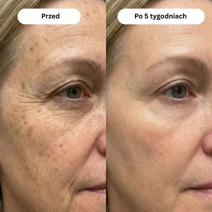 Wapniowy balsam przeciwzmarszczkowy