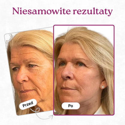 Wapniowy balsam przeciwzmarszczkowy